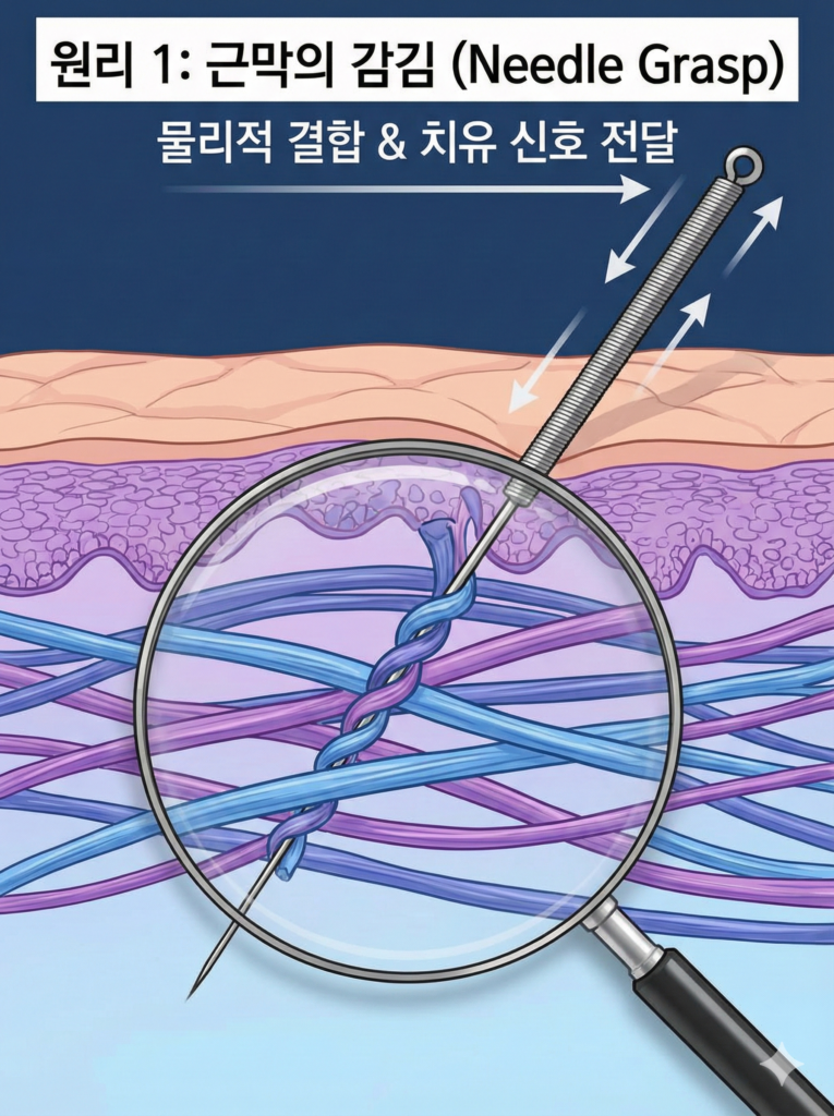 침 통증, 부작용일까요? 과학으로 밝혀진 원인 3가지 침치료 후 통증 (2)