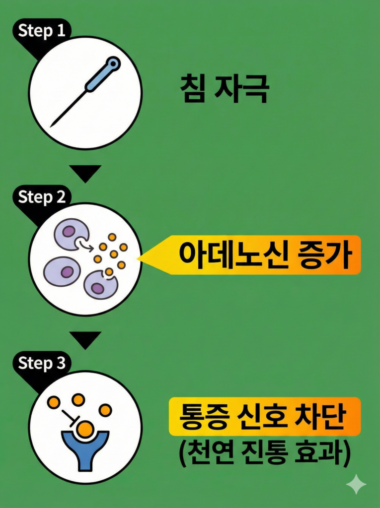 침 통증, 부작용일까요? 과학으로 밝혀진 원인 3가지 침치료 후 통증 (3)